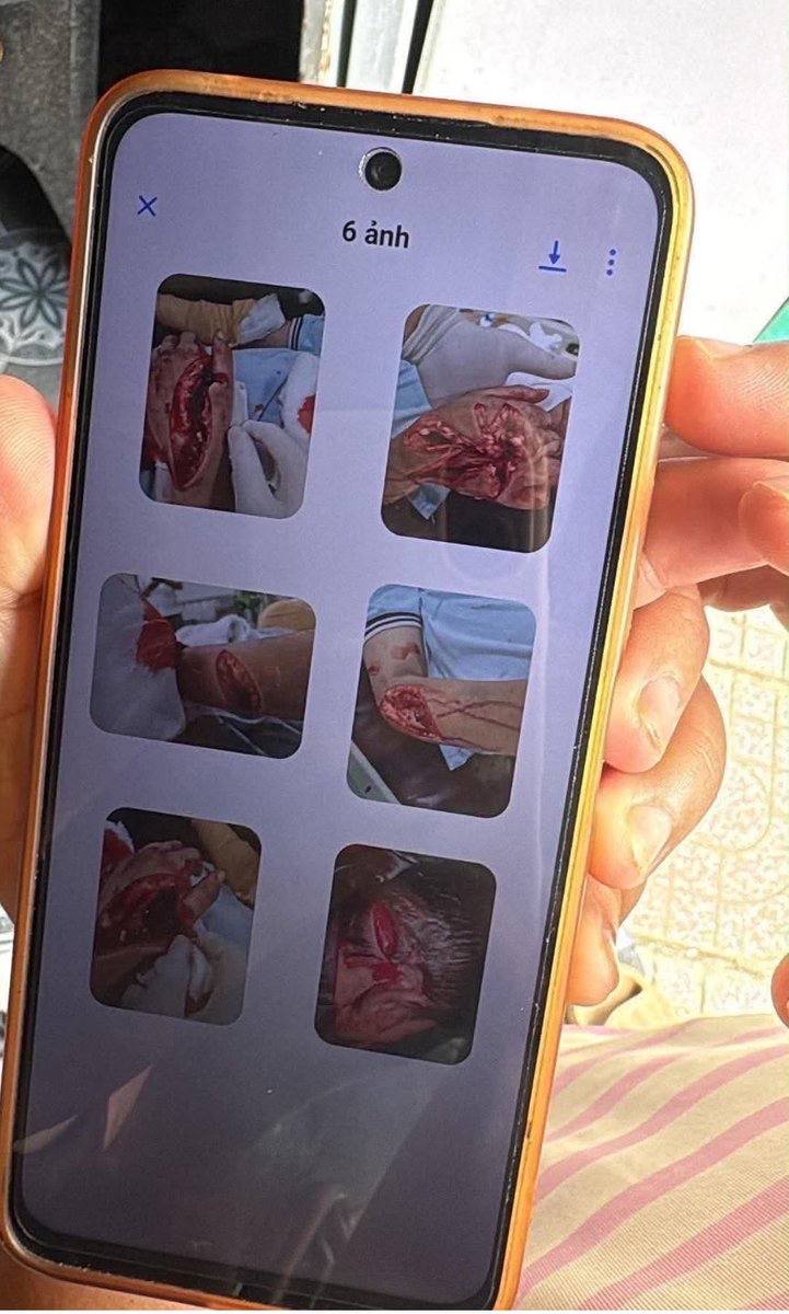 热议|越南巴地市第七年级学生持刀刺伤十多人,据说有学生死亡 ,图片慎点 网配图