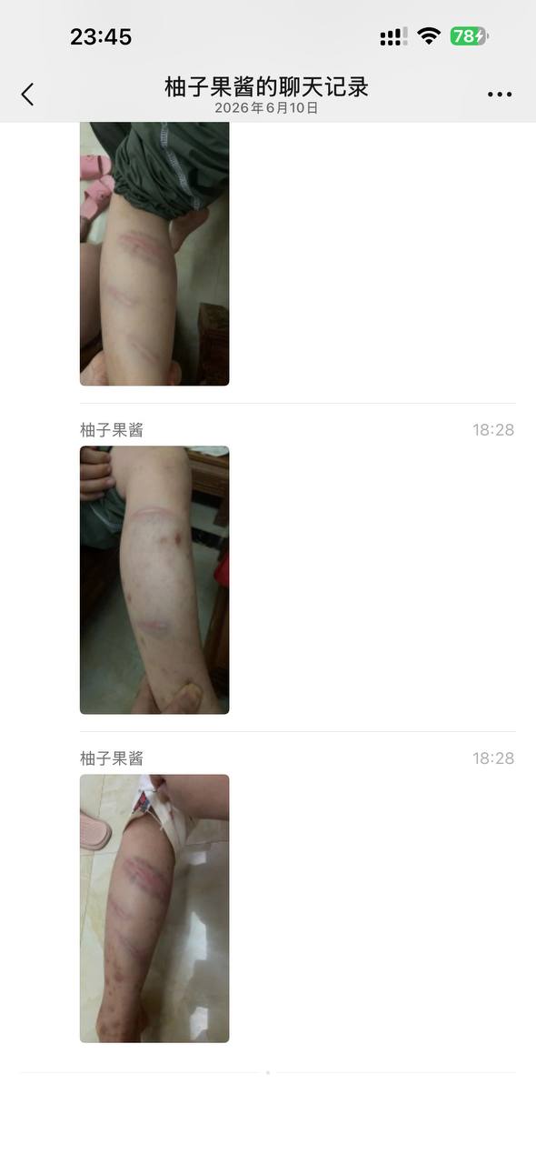 热议｜这老师下手够狠的 这得被气多重。不过应该可以放假了 基本告别教师生涯配图 3