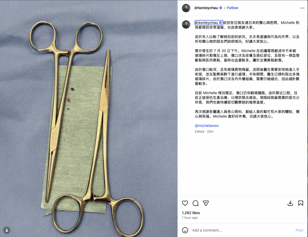 卫诗雅拍《狩谎》受伤嘴缝50针 丈夫发文报平安配图