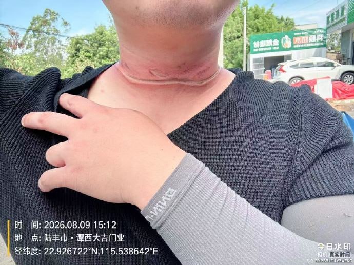 热议｜这可真是命大呀相关爆料引关注，事件进展持续整理配图 3
